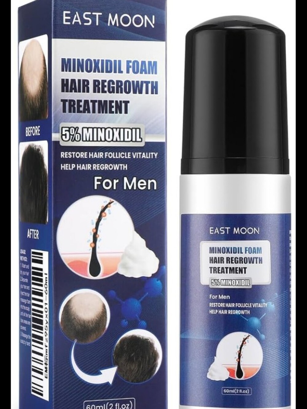 Men’s Minoxidil Foam 5% Hair Regrowth Treatment